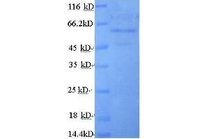 Cytochrome B5 Reductase 3 (CYB5R3) (AA 1-301), (full length) protein (GST tag)