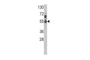 Western blot analysis of IL17RB Antibody (Center) (ABIN390727 and ABIN2841000) in MDA-M cell line lysates (35 μg/lane). (IL17 Receptor B Antikörper  (AA 207-234))