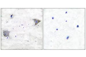 Immunohistochemistry (IHC) image for anti-Platelet Derived Growth Factor Receptor alpha (PDGFRA) (C-Term) antibody (ABIN1848738)