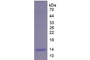 SDS-PAGE analysis of Rat UCP2 Protein.