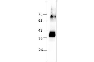 Western Blotting (WB) image for Chemokine (C-C Motif) Receptor 5 (CCR5) (AA 1-352) protein (Strep Tag) (ABIN3113835)