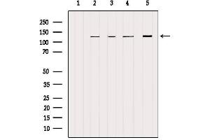 Western blot analysis of extracts from various samples, using NCKAP1 Antibody. (NCKAP1 Antikörper  (Internal Region))