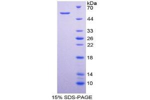 SDS-PAGE (SDS) image for CD320 Molecule (CD320) (AA 36-256) protein (His tag,GST tag) (ABIN1980878)