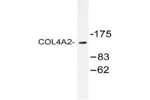 Western blot (WB) analysis of COL4A2 antibody in extracts from Jurkat cells. (COL4a2 Antikörper  (Chain alpha 2))