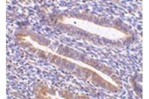 Immunohistochemistry of TIM-1 in human uterus tissue with this product at 10 μg/ml. (HAVCR1 Antikörper  (N-Term))