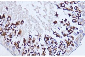Immunohistochemistry of paraffin-embedded Rat testis using Polyclonal AntibodyPC1 Polyclonal Antibody at dilution of 1:100 (40x lens). (PC1 Antikörper)