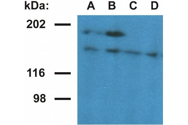 Ubinuclein 1 Antikörper  (AA 1-190)