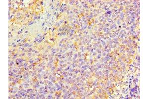 Immunohistochemistry of paraffin-embedded human tonsil tissue using ABIN7157433 at dilution of 1:100 (KRT6A Antikörper  (AA 2-564))