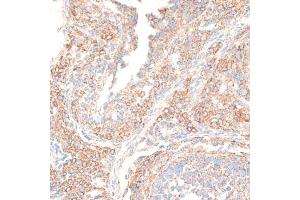 Immunohistochemistry of paraffin-embedded rat ovary using KIF14 antibody (ABIN6129691, ABIN6142854, ABIN6142855 and ABIN6214465) at dilution of 1:100 (40x lens). (KIF14 Antikörper  (AA 1399-1648))