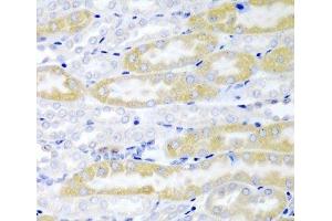 Immunohistochemistry of paraffin-embedded Mouse kidney using FABP6 Polyclonal Antibody at dilution of 1:200 (40x lens). (FABP6 Antikörper)