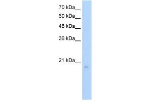 WB Suggested Anti-RGS8 Antibody Titration:  5.