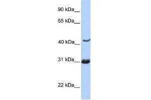 WB Suggested Anti-NUP35 Antibody Titration: 0. (NUP35 Antikörper  (C-Term))