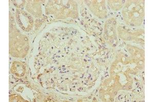 Immunohistochemistry of paraffin-embedded human kidney tissue using ABIN7145914 at dilution of 1:100 (CCR1 Antikörper  (AA 306-355))