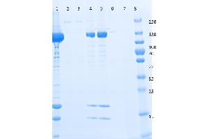 SDS-PAGE of Anti-DYKDDDDK  Affinity Gel. (DYKDDDDK Tag Antikörper  (Agarose Beads))