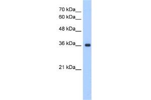 WB Suggested Anti-ELOVL7 Antibody Titration:  1. (ELOVL7 Antikörper  (N-Term))