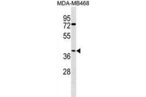 Western Blotting (WB) image for anti-Abhydrolase Domain Containing 1 (ABHD1) antibody (ABIN3000271) (ABHD1 Antikörper)