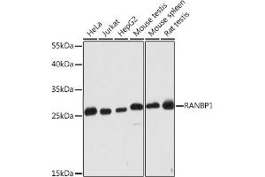 Western blot analysis of extracts of various cell lines, using R Rabbit pAb (ABIN7269841) at 1:2000 dilution. (RANBP1 Antikörper  (AA 1-100))