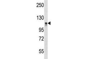 Dnmt3a antibody western blot analysis in CEM lysate. (DNMT3A Antikörper  (AA 872-900))