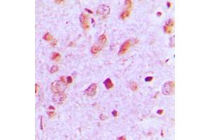 Immunohistochemical analysis of Cytokeratin 13 staining in human brain formalin fixed paraffin embedded tissue section. (Cytokeratin 13 Antikörper  (Center))