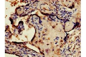 Immunohistochemistry of paraffin-embedded human placenta tissue using ABIN7148675 at dilution of 1:100 (CRTC1 Antikörper  (AA 1-248))