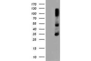 HEK293T cells were transfected with the pCMV6-ENTRY control (Left lane) or pCMV6-ENTRY ERCC1 (Right lane) cDNA for 48 hrs and lysed. (ERCC1 Antikörper)