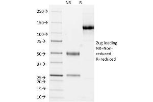 SDS-PAGE Analysis Purified Cytokeratin 10/13 Monoclonal Antibody (DE-K13). (KRT10, KRT13 Antikörper)