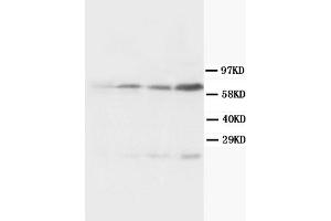 Western Blotting (WB) image for anti-Bridging Integrator 1 (BIN1) (AA 189-398) antibody (ABIN1105531) (BIN1 Antikörper  (AA 189-398))