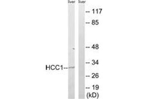 Western blot analysis of extracts from mouse liver cells, using HCC1 Antibody. (RBM39 Antikörper  (AA 147-196))