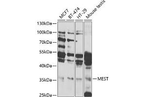 Western blot analysis of extracts of various cell lines, using MEST antibody (ABIN6133292, ABIN6143749, ABIN6143751 and ABIN6222673) at 1:1000 dilution. (MEST Antikörper  (AA 146-335))