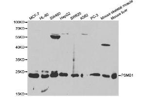Western blot analysis of extracts of various cell lines, using PSMB1 antibody. (PSMB1 Antikörper  (AA 29-241))