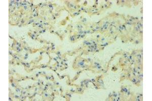 Immunohistochemistry of paraffin-embedded human lung tissue using ABIN7168147 at dilution 1:100 (RRM2B Antikörper  (AA 1-351))