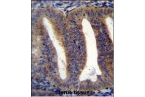 RBS2 Antibody (Center) (ABIN656055 and ABIN2845413) immunohistochemistry analysis in formalin fixed and paraffin embedded human uterus tissue followed by peroxidase conjugation of the secondary antibody and DAB staining. (RBPMS2 Antikörper  (AA 113-141))