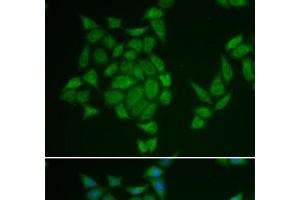 Immunofluorescence analysis of HeLa cells using AMPD3 Polyclonal Antibody (AMPD3 Antikörper)