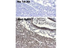 Immunohistochemistry (IHC) image for anti-RAB5A, Member RAS Oncogene Family (RAB5A) (C-Term) antibody (ABIN1440056) (RAB5 Antikörper  (C-Term))