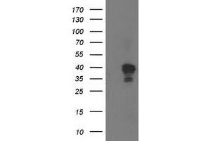 Western Blotting (WB) image for anti-NudE Nuclear Distribution E Homolog (A. Nidulans)-Like 1 (NDEL1) antibody (ABIN1499854) (NDEL1 Antikörper)