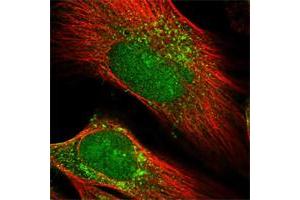 Immunofluorescent staining of human cell line U-251 MG shows positivity in nucleus & vesicles.