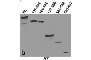 Characterization of purity and antigenicity of CKAP4 constructs.