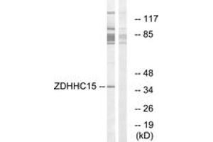 Western blot analysis of extracts from Jurkat cells, using ZDHHC15 Antibody. (ZDHHC15 Antikörper  (AA 288-337))