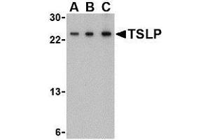 Western blot analysis of TSLP in A-20 cell lysate with TSLP antibody at (A) 0.