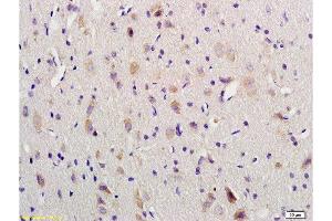 Formalin-fixed and paraffin embedded rat brain labeled with Anti-VIP Polyclonal Antibody, Unconjugated  1:200 followed by conjugation to the secondary antibody and DAB staining (Vip Antikörper  (AA 125-152))