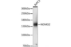 Western blot analysis of extracts of BxPC3 cells using NOMO2 Polyclonal Antibody at dilution of 1:1000. (NOMO2 Antikörper)