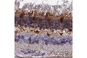 Immunohistochemical staining of human retina shows strong cytoplasmic positivity in photoreceptor layer and outer plexiform layer. (GCAP1 Antikörper)