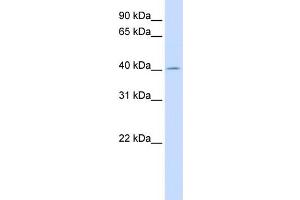 WB Suggested Anti-ACAA2 Antibody Titration:  0. (ACAA2 Antikörper  (N-Term))