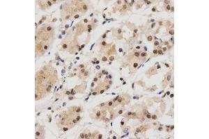 Immunohistochemistry of paraffin-embedded human stomach using KPNA4 Antibody (ABIN5971058) at dilution of 1/200 (40x lens). (KPNA4 Antikörper)