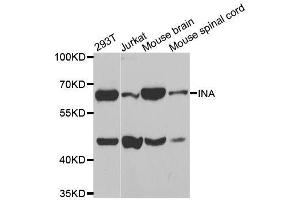 Western blot analysis of extracts of various cell lines, using INA antibody. (INA Antikörper)