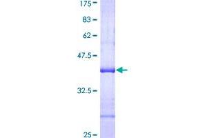 NAT2 Protein (AA 96-195) (GST tag)