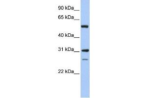 IMPDH1 antibody used at 1 ug/ml to detect target protein. (IMPDH1 Antikörper)