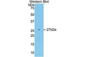 Western blot analysis of the recombinant protein. (Neuregulin 1 Antikörper  (AA 20-242))