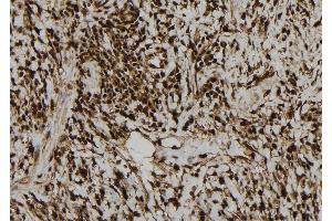 ABIN6276940 at 1/100 staining Human gastric tissue by IHC-P.