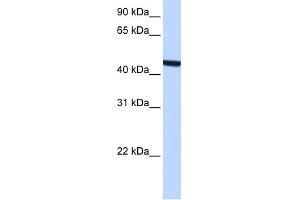 WB Suggested Anti-ZCCHC3 Antibody Titration:  0. (ZCCHC3 Antikörper  (Middle Region))